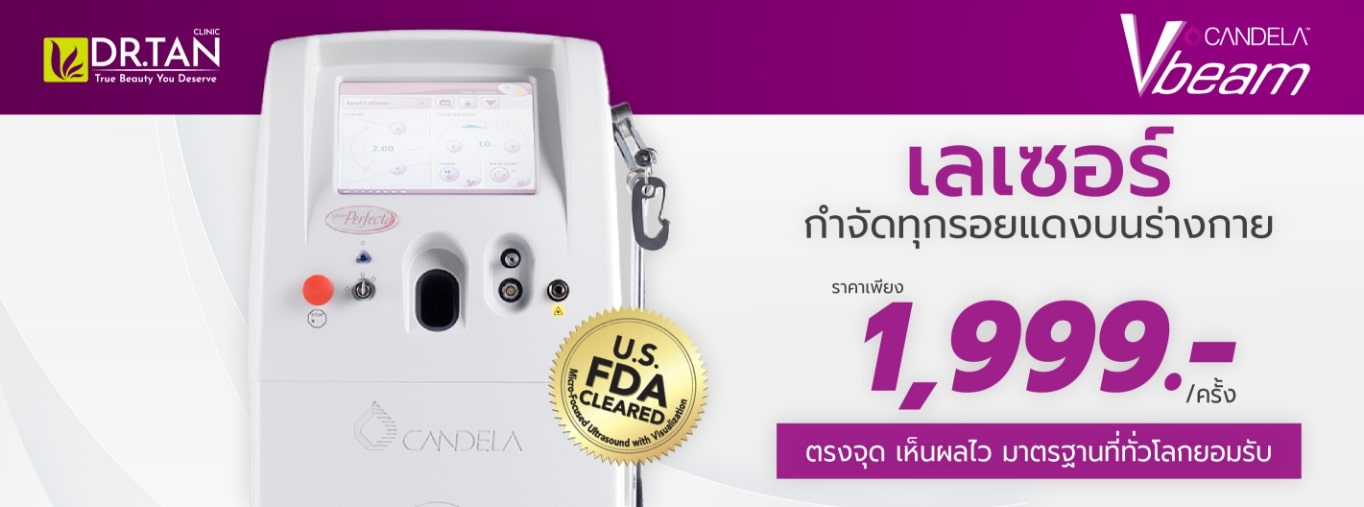 VBeam Laser Dr.Tan Clinic