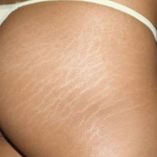 Striae-rubra2 Striae-rubra2