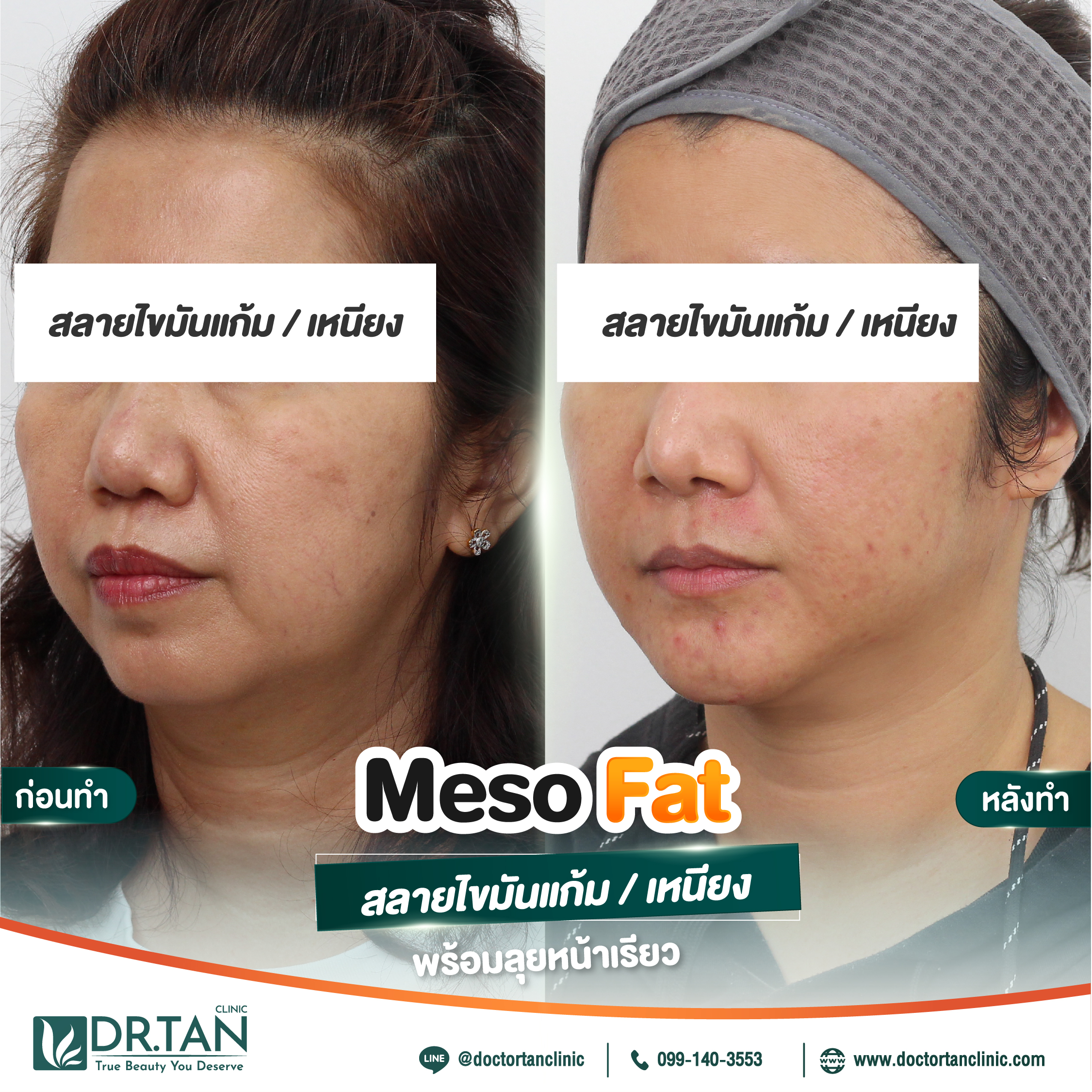 fat-05